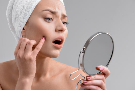 Get rid of pimple redness in no time!