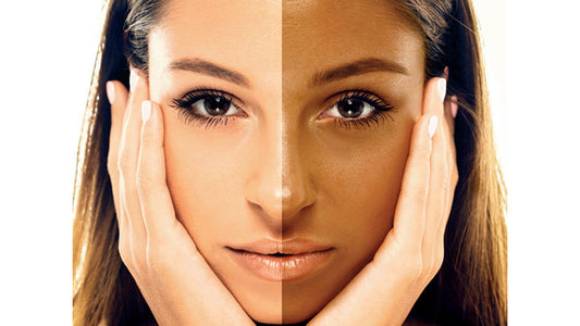 Use these 3 natural ingredients for removing the unwanted skin tan