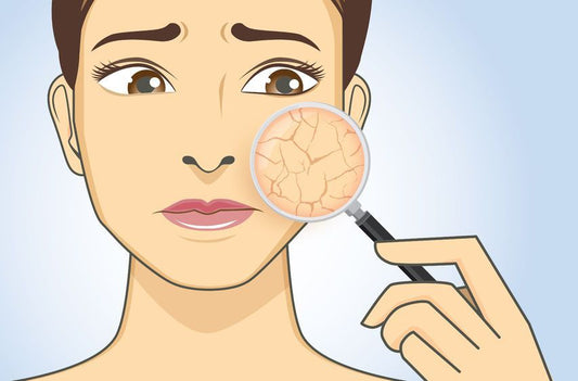 Struggling with dry skin?