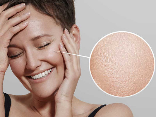 Start the beauty diet today and get rid of the oily skin!