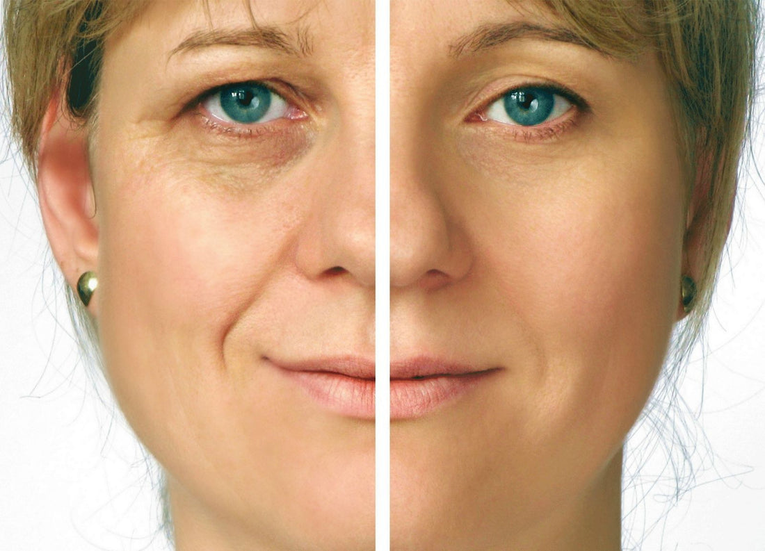 Protect the skin with antioxidants