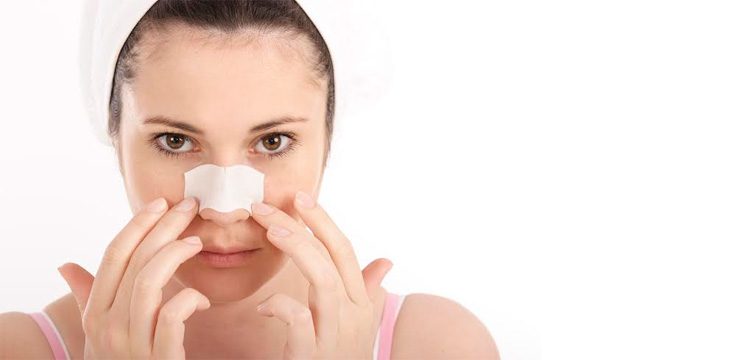 Get rid of blackheads naturally