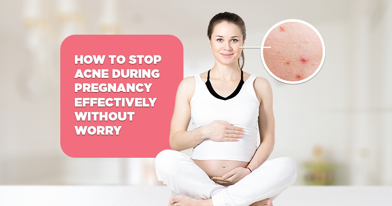 Acne during pregnancy