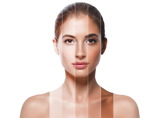 Natural remedies for blotchy and uneven skin!