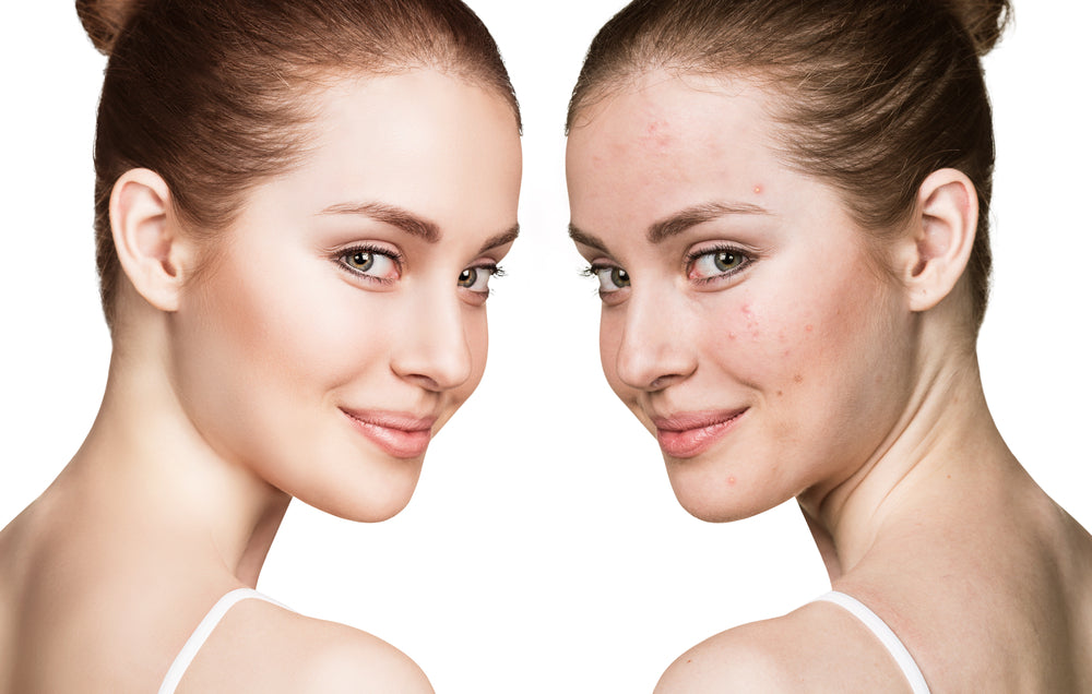 Skin care regimen before and after the menstrual cycle