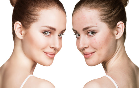 Skin care regimen before and after the menstrual cycle