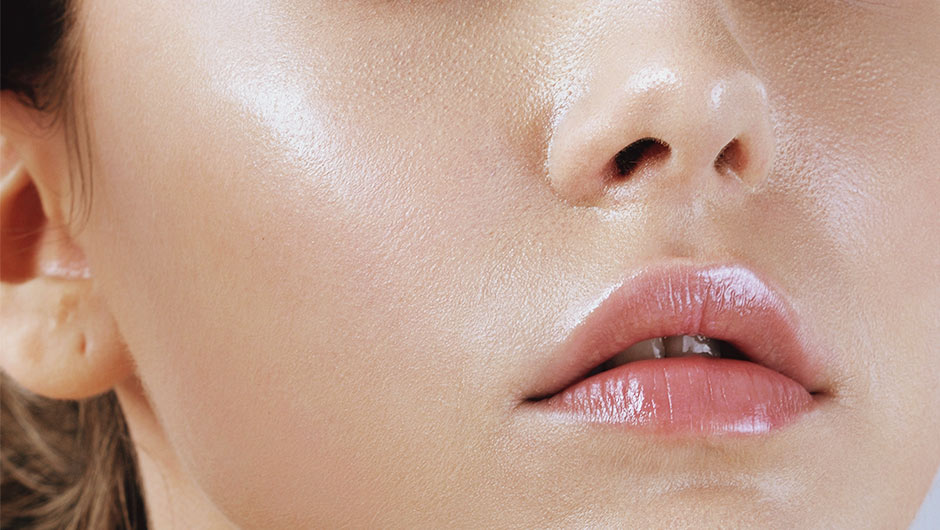 What causes oily skin?