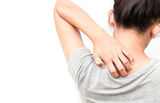 Save your skin from mosquito bites this summer