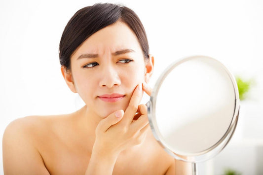 These habits are making your acne worse!