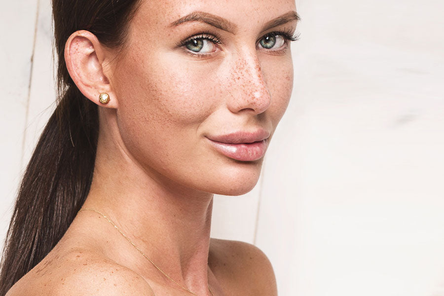 Get rid of those sun spots on your skin!