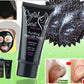 blackheads removal